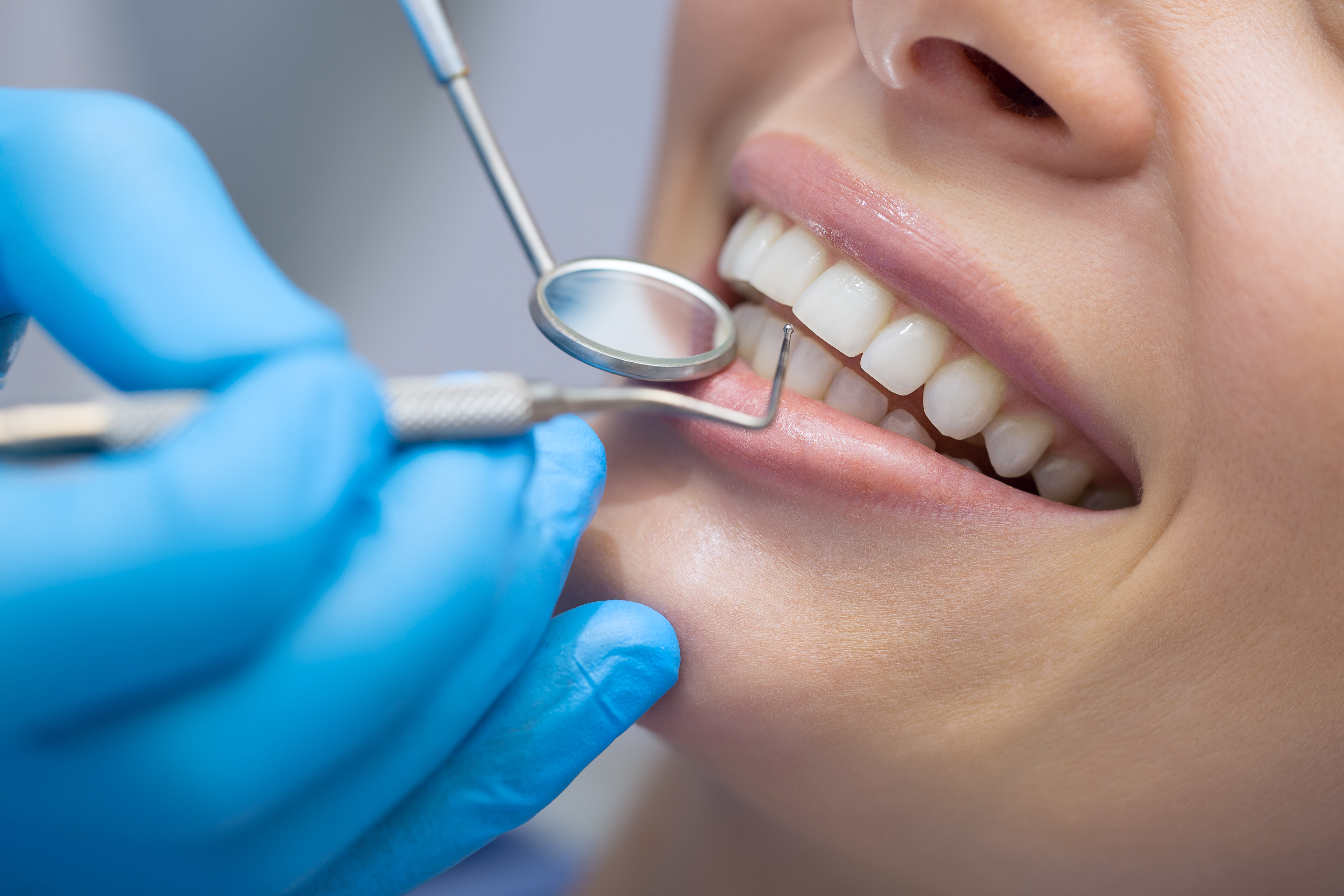 inflamación de encías-gingivitis_periodontitis-clínica dental-Tenerife